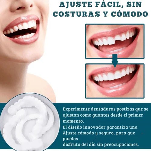 SMILEY® -SONRISA RESTAURADA EN MINUTOS - 57% OFF SOLO HOY HASTA 23:59!!!