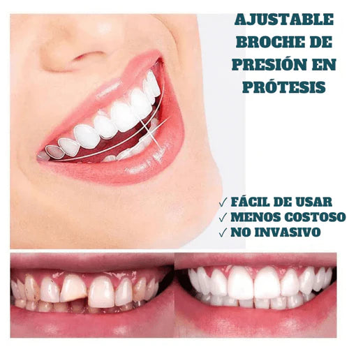 SMILEY® -SONRISA RESTAURADA EN MINUTOS - 57% OFF SOLO HOY HASTA 23:59!!!