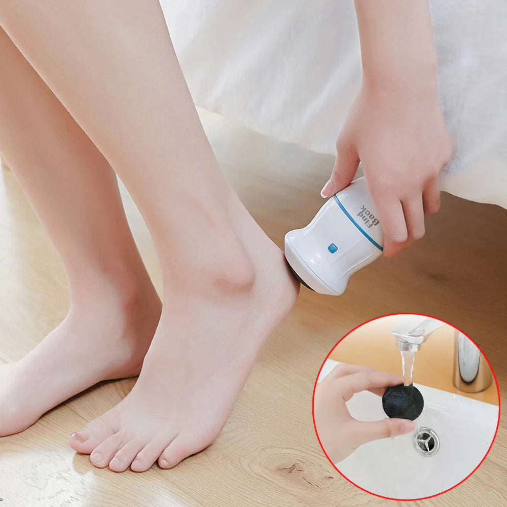 Removex® Quita Callos - Removedor de Callos Electrico 50% OFF