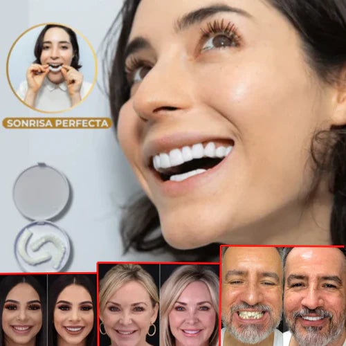 SMILEY® -SONRISA RESTAURADA EN MINUTOS - 57% OFF SOLO HOY HASTA 23:59!!!